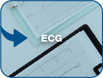 ecg